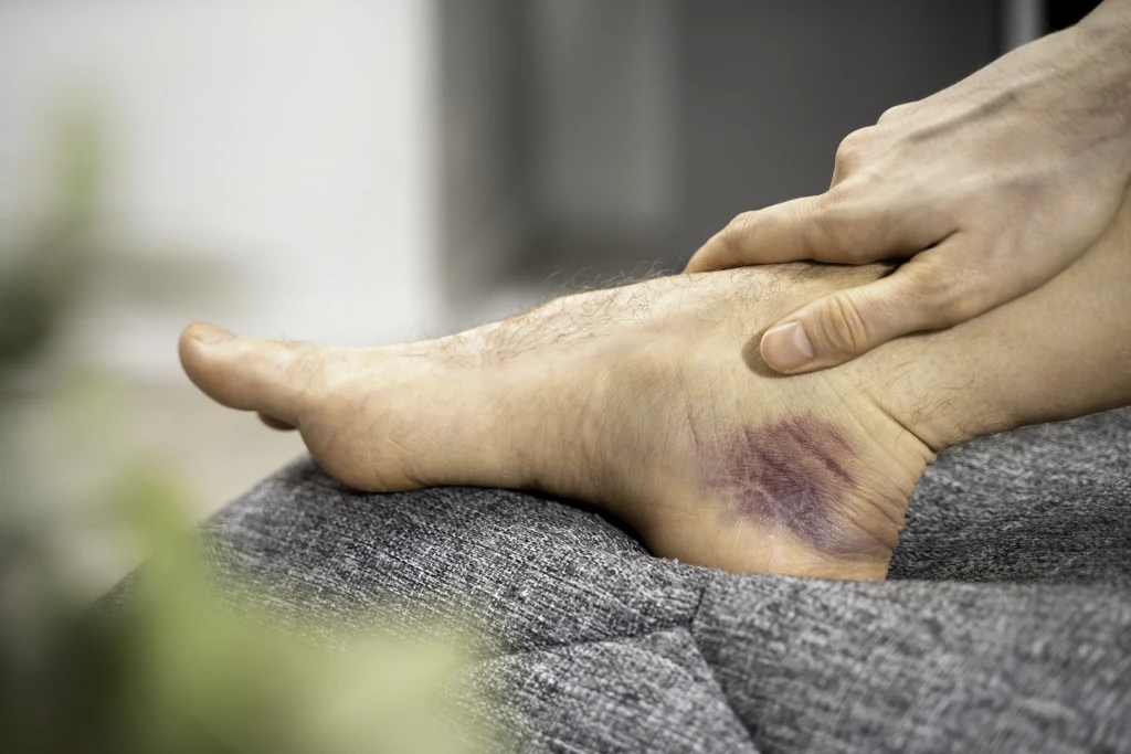 Sore Ankle Areas: Support Recovery With Gentle Activity